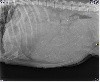  - Radiographie du 22 mars 2018